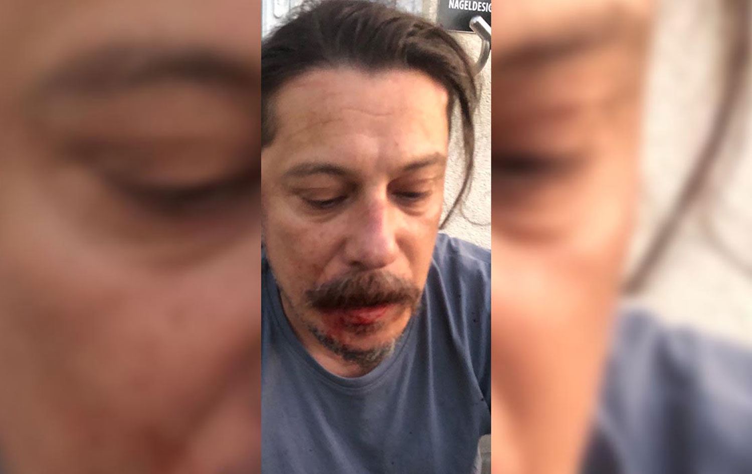 Li Almanyayê êrişî rojnamevan Erk Acarer hat kirin