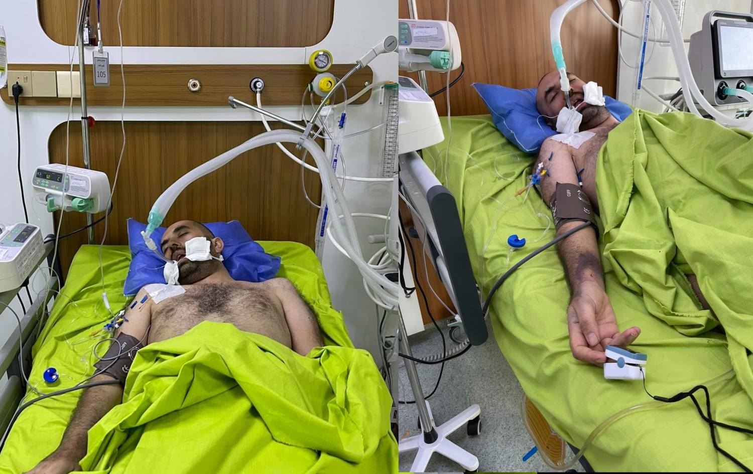 هونەر مزووری بەهۆی تووشبوون بە کۆرۆنا دۆخی تەندروستیی ناجێگیرە