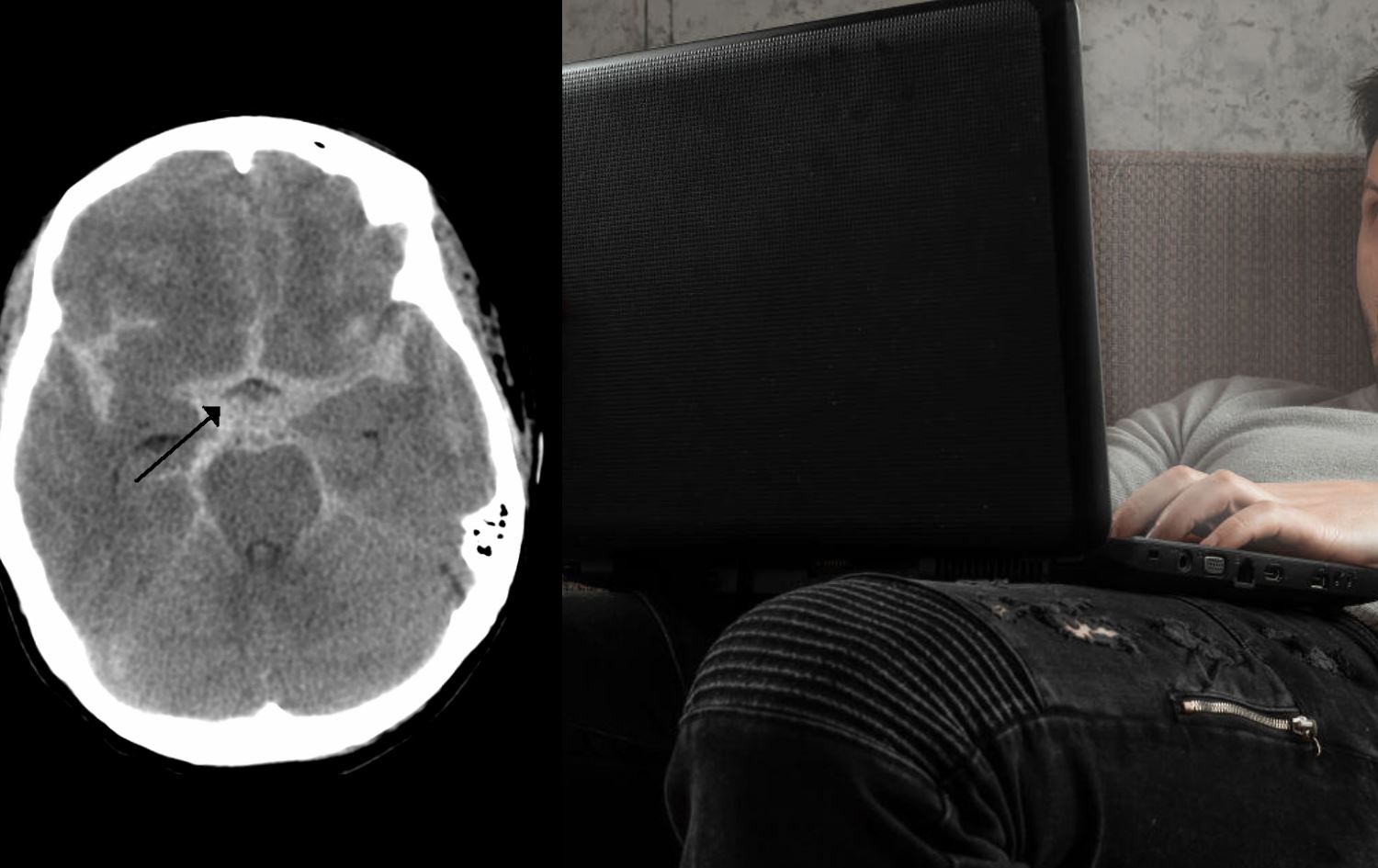 لە ژاپۆن پیاوێک بەهۆی 'خووی نهێنییەوە' تووشی جەڵتەی مێشک دەبێت