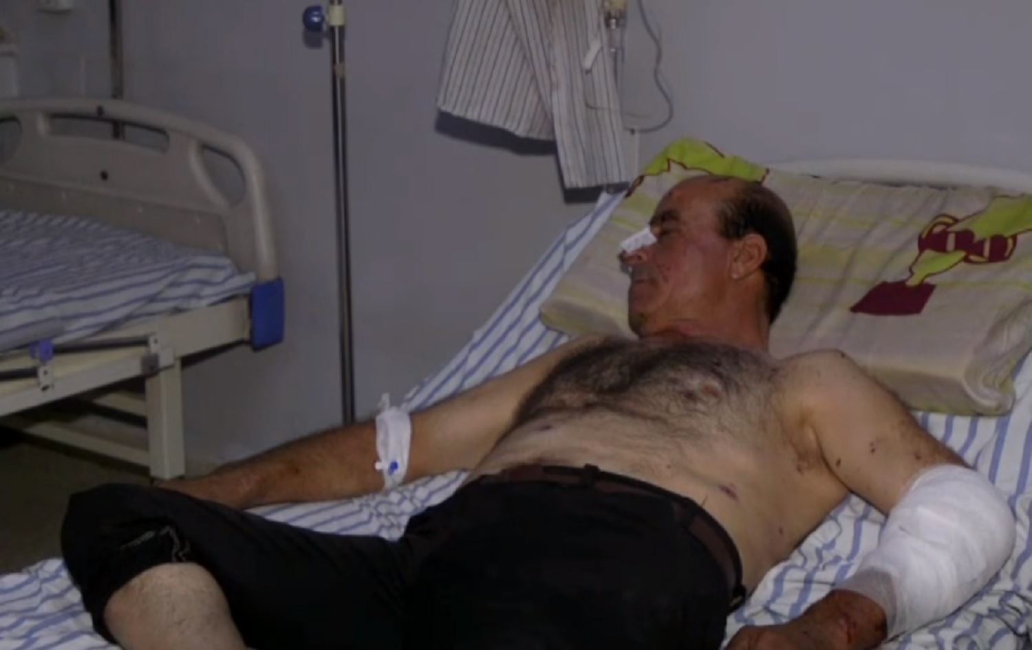 Birîndarekî topbarana Zirganê: Li ser hev top diketin, qet derfet nedidan mirov