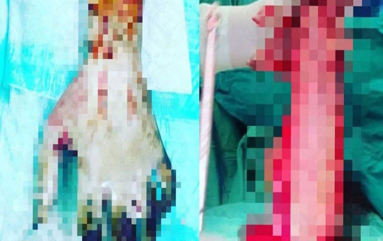 Korkunç infaz: Aşık olan kız babası tarafından diri diri yakıldı