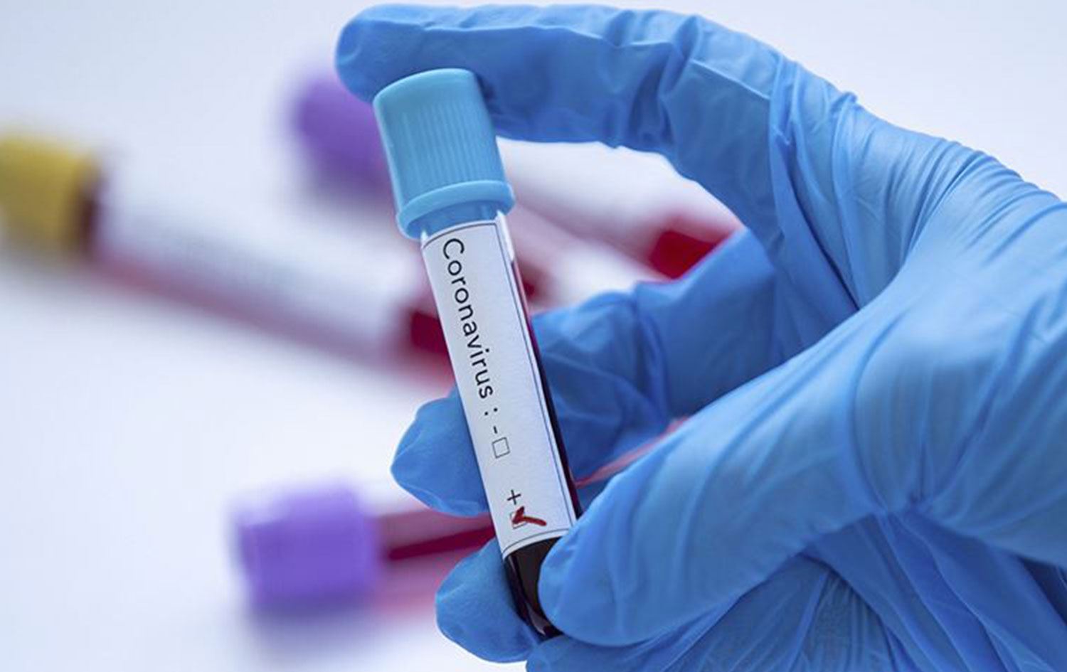 ABD istihbaratı raporu: Koronavirüs silah olarak üretilmedi