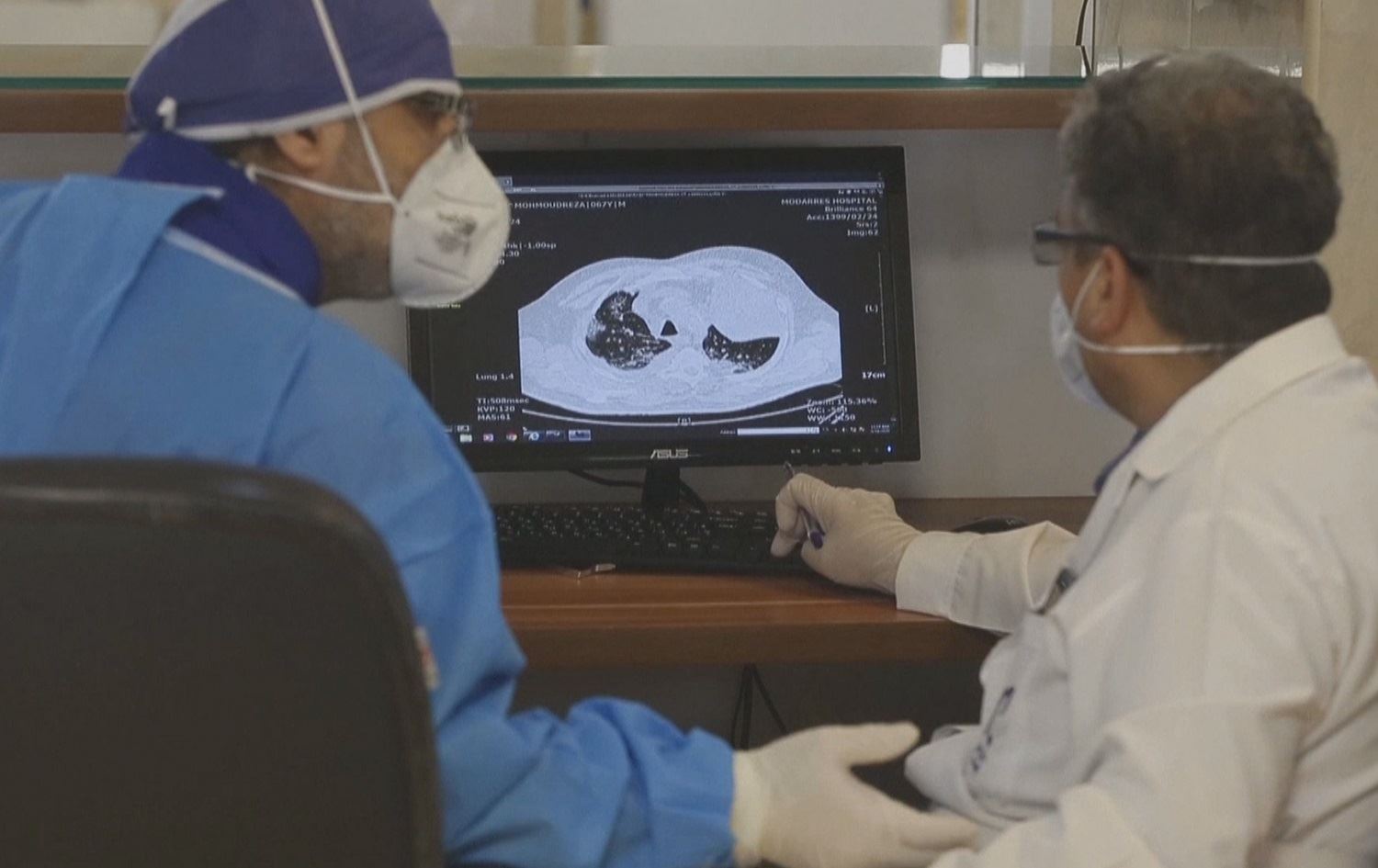 Li Rojhilatê Kurdistanê pirsgirêka kêmiya bijîşkên pispor heye