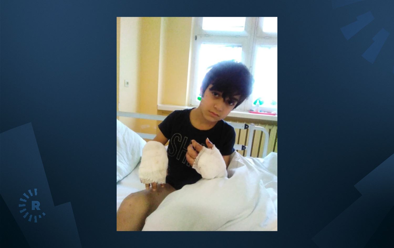 منداڵە کۆچبەرێکی کورد بە خواردنەوەی ئاوی پیس تووشی نەخۆشییەکی پێست دەبێت