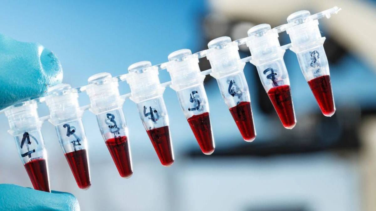 Evlilik öncesi SMA taraması, aile hekimliklerinde başlıyor