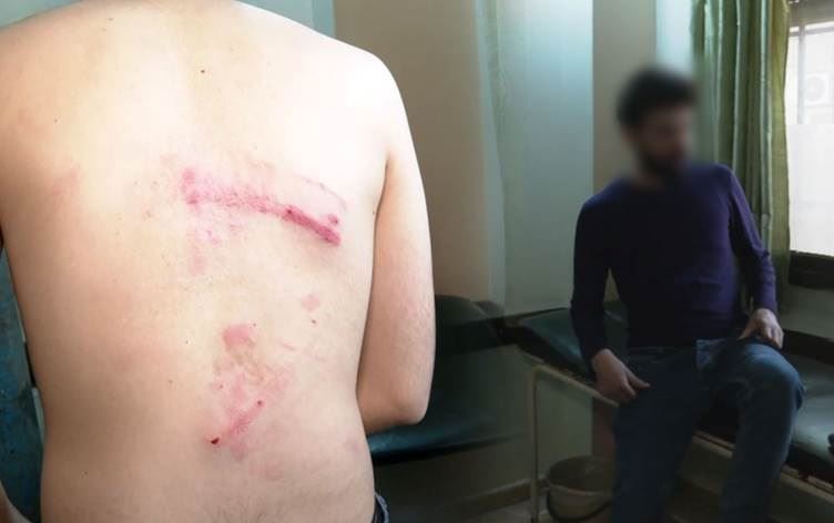 Li Qamişlo êrişî tîma Rûdawê hat kirin û wênegir hat îşkencekirin