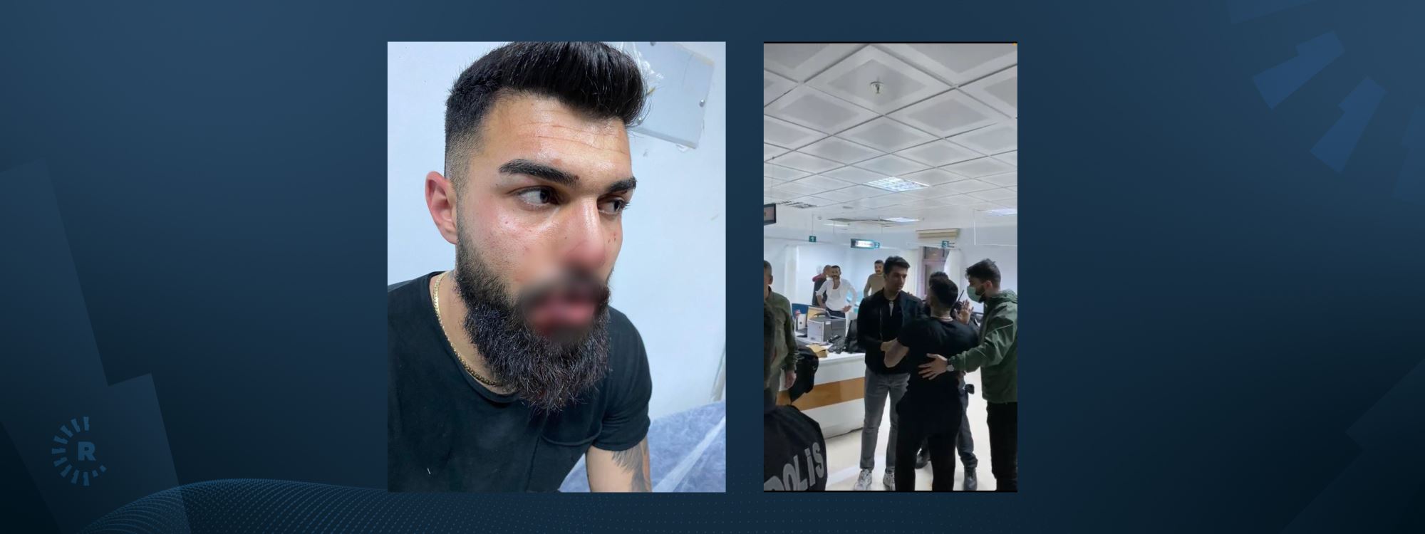 Dersim’de yolda yürüyen genç, Özel Harekat tarafından gözaltına alınıp darp edildi