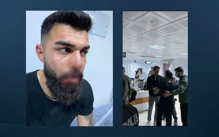 Valilik Özel Harekat polisleri hakkında açıklama yaptı, gencin darp edilmesine değinmedi