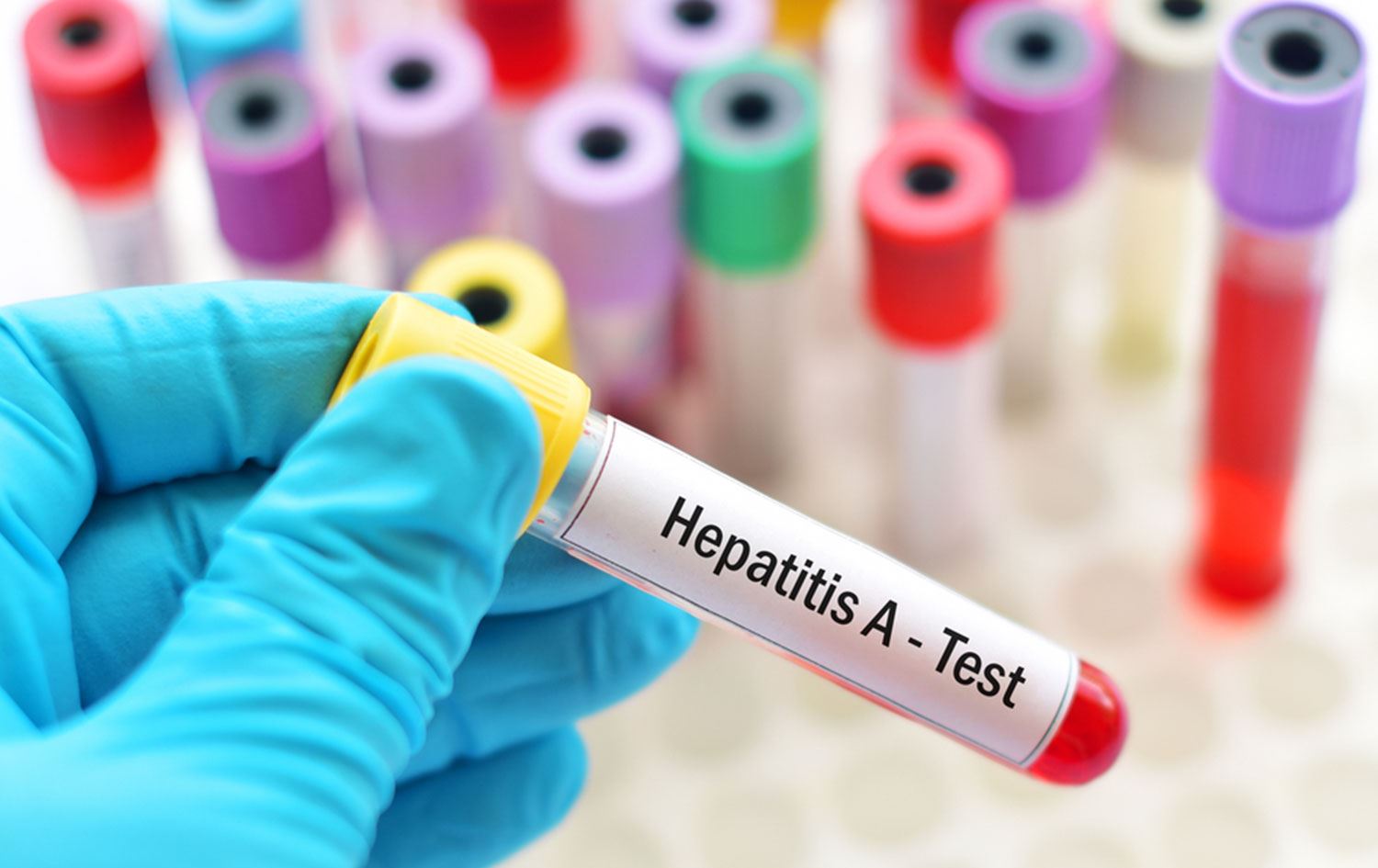 Gizemli virüs Kanada’da da görüldü