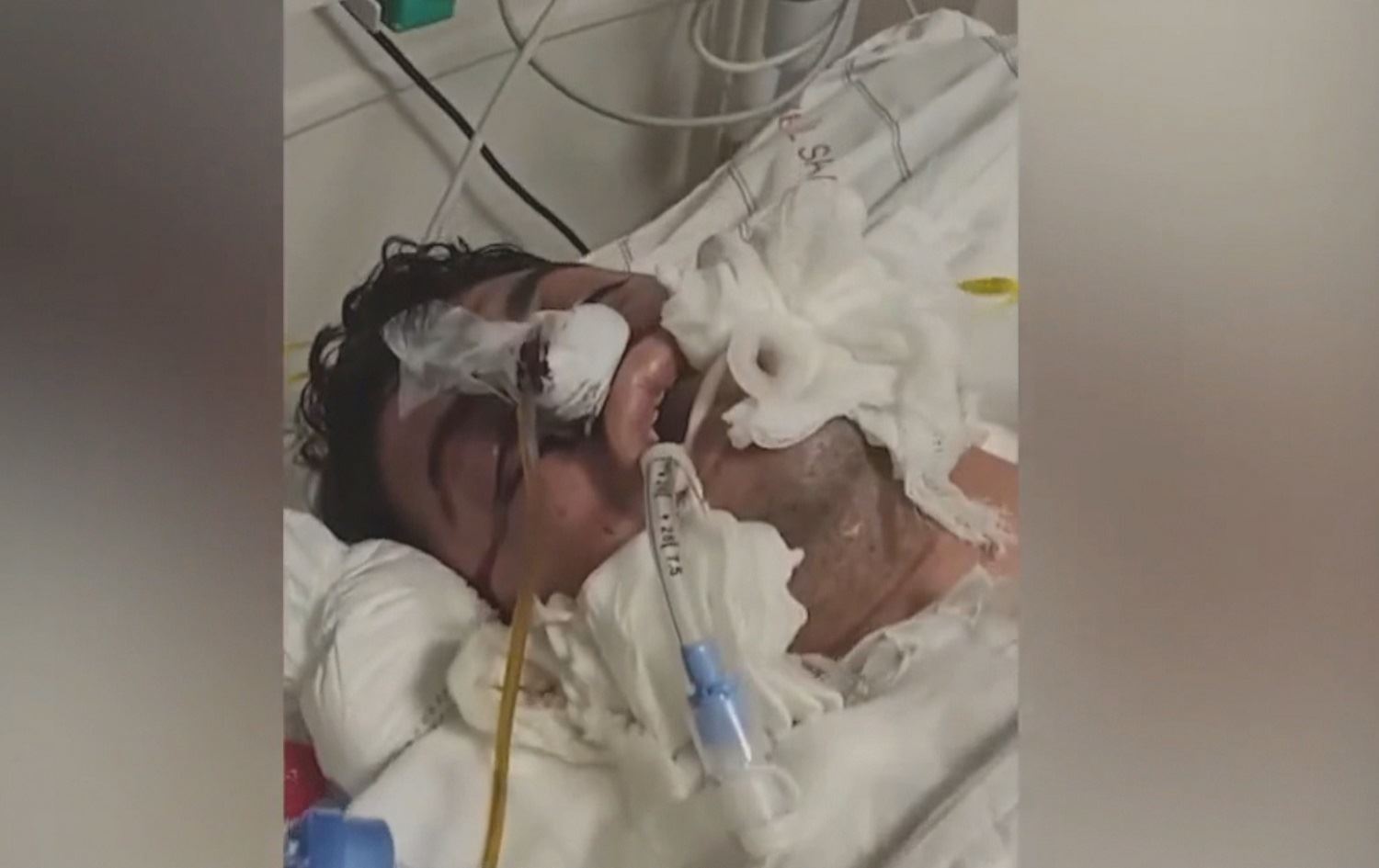 SAVCILIK KALP KRİZİ DEMİŞTİ- Hayatını kaybeden Ferhan Yılmaz’ın koğuşunda kalanlar ‘baskın yapıldı’ dedi