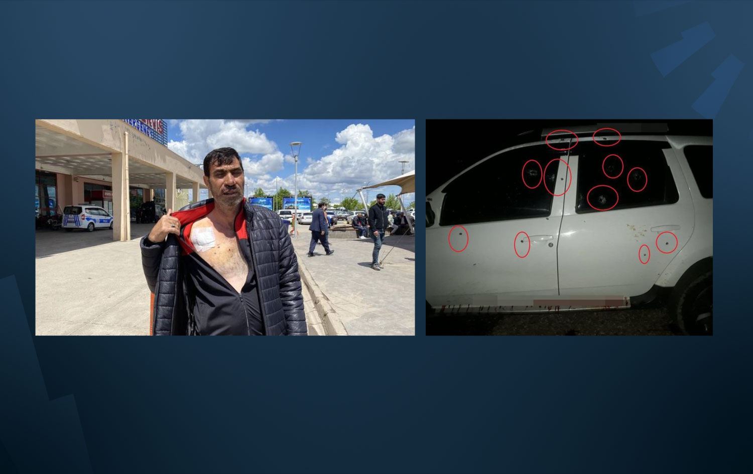 Diyarbakır’da çapraz ateşe tutulan Dağ: Ölü taklidi yaparak kurtuldum