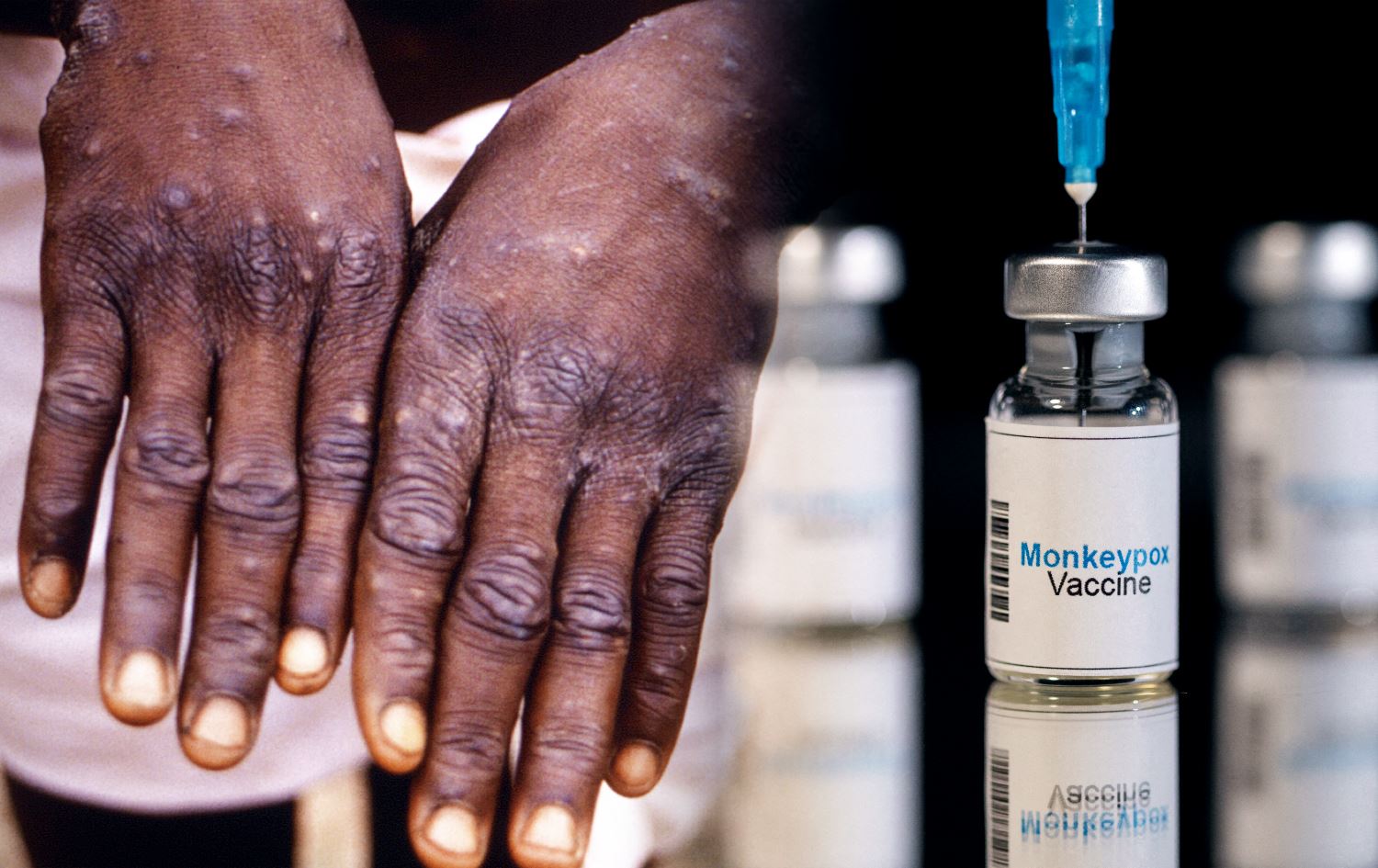 ڤاکسینی ئاوڵەی مەیموون رەوانەی وڵاتان دەکرێت