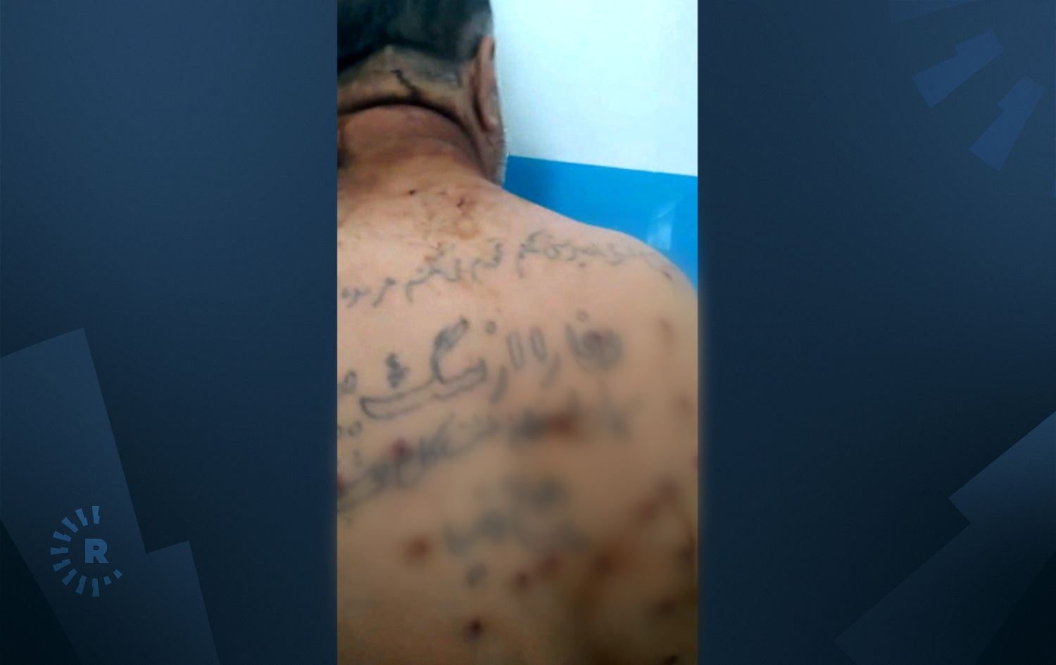 لە بانە پاسەوانی سنووریی ئێران 12 کۆڵبەر بە تاپڕ بریندار دەکات