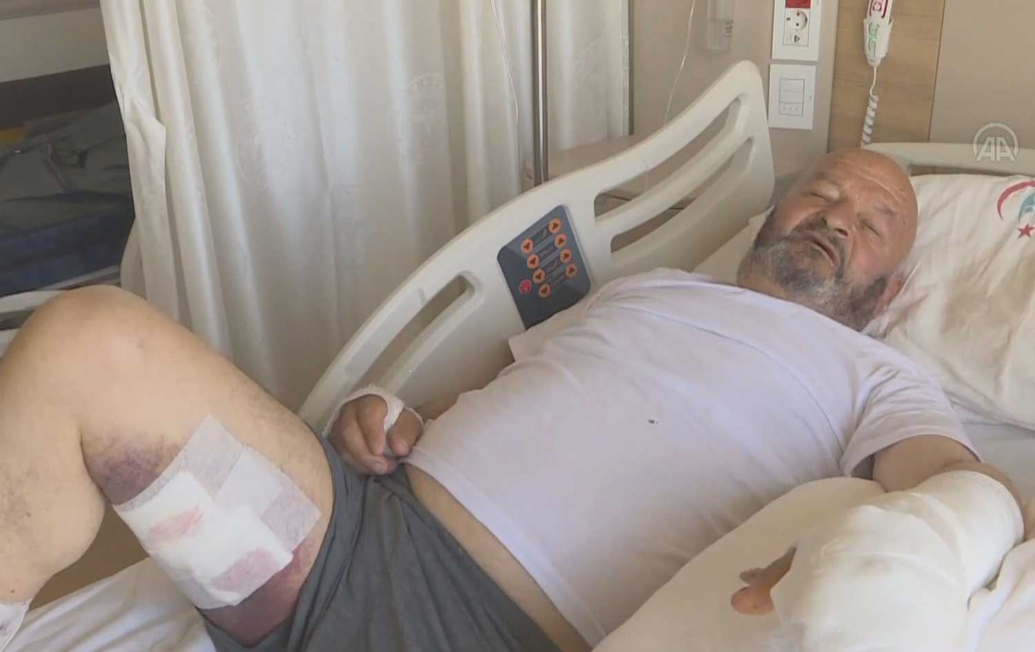 لە ئەرزەڕۆم ورچ پەلاماری پیاوێک دەدات و 4 رۆژە لە نەخۆشخانەیە