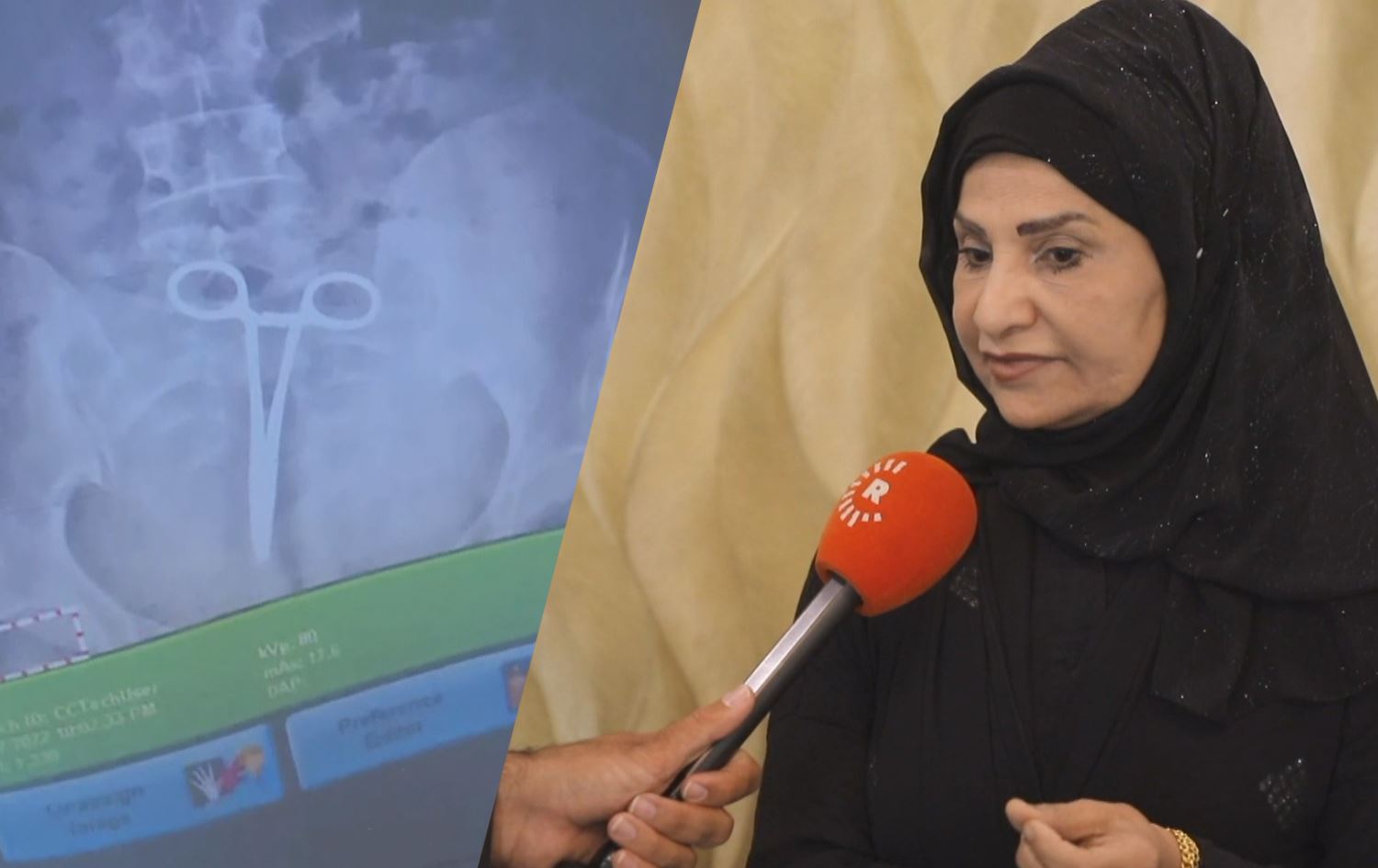 ئەو پزیشکەی لەکاتی نەشتەرگەری مقەستێکی لە سکی ژنێکدا لێ بەجێما: ئەرکی من نییە مقەست بژمێرم