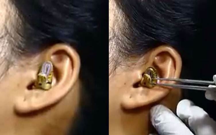 VIDEO - Li Hindistanê bûyereke sosret: Mar çû guhê jinekê