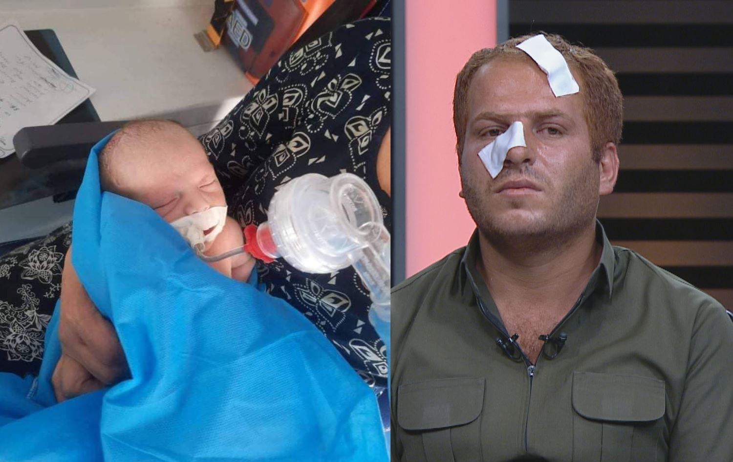 Annesi İran saldırısında ölürken doğmuştu; Wanyar bebeğin beyin ölümü gerçekleşti