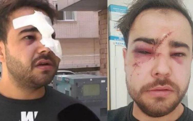 ‘İstek parça’ bilmeyen müzisyenin yüzünde içki şişesi kırdılar