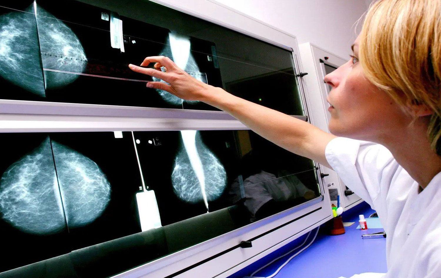 ARAŞIRMA – Kanser her yıl 1 milyon çocuğu annesiz bırakıyor