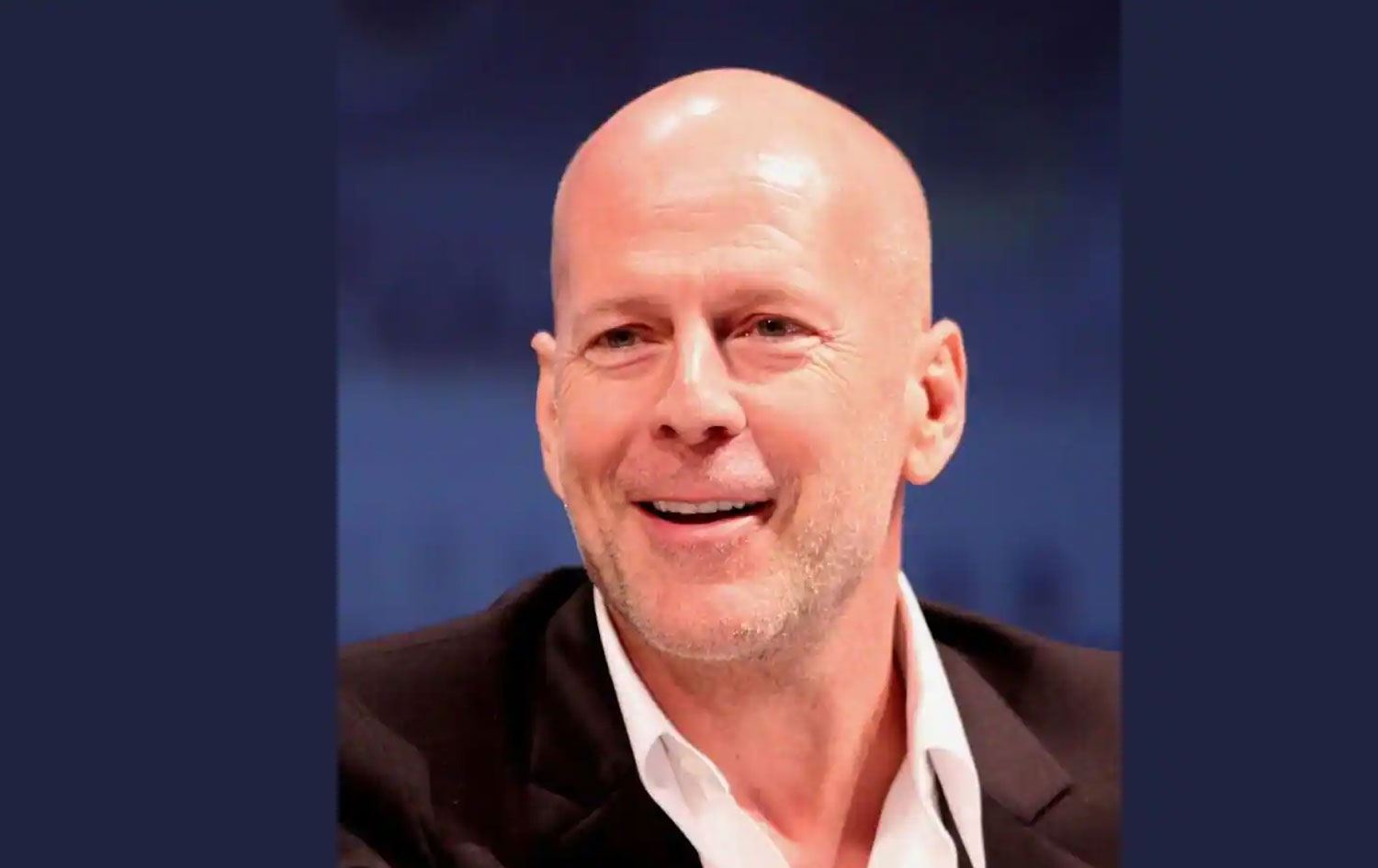 Kellere müjde: Laboratuvarda saç üretildi, kellik tarih oluyor!