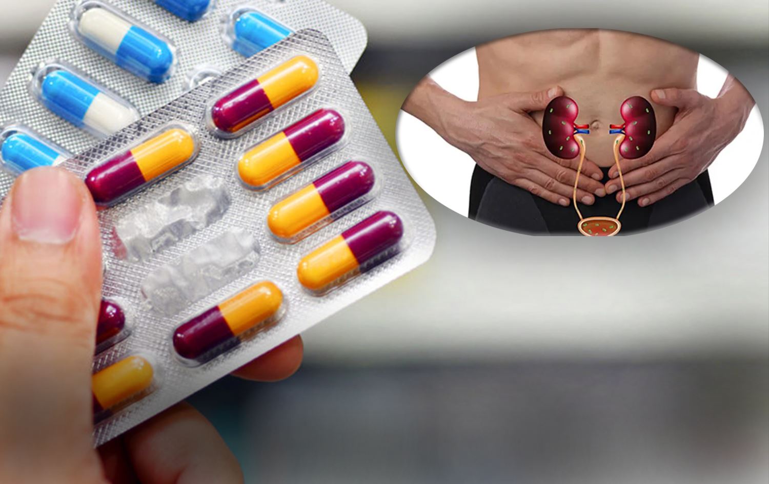 توێژینەوەیەکی ئەمریکی دوو دەرمان بۆ چارەسەری هەوکردنی بۆری میز پێشنیازدەکات
