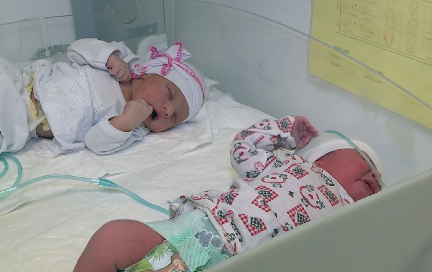 لە 10 مانگی رابردوودا لە کۆی 13661 منداڵی تازە لەدایکبوو لە دهۆک 36%یان بە نەشتەرگەری بووە