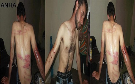 Artêşa Azad a Sûriyê xortekî kurd êşkence kir