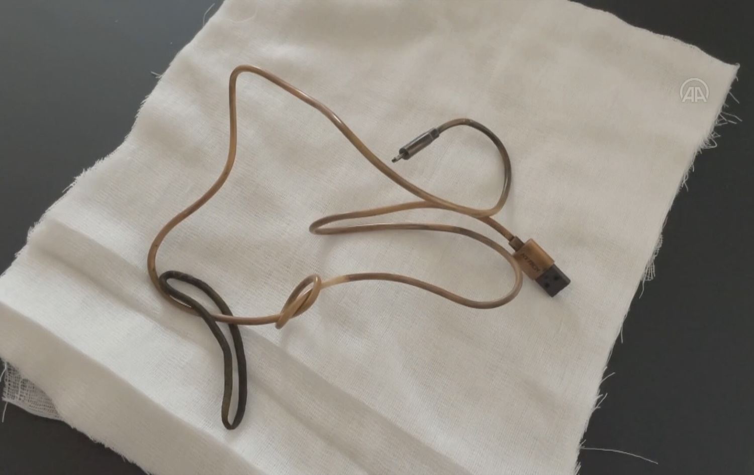 لە خارپێت وایەری بارگاویکردنەوەی مۆبایل لە گەدەی مێرمنداڵێک دەرهێنرا