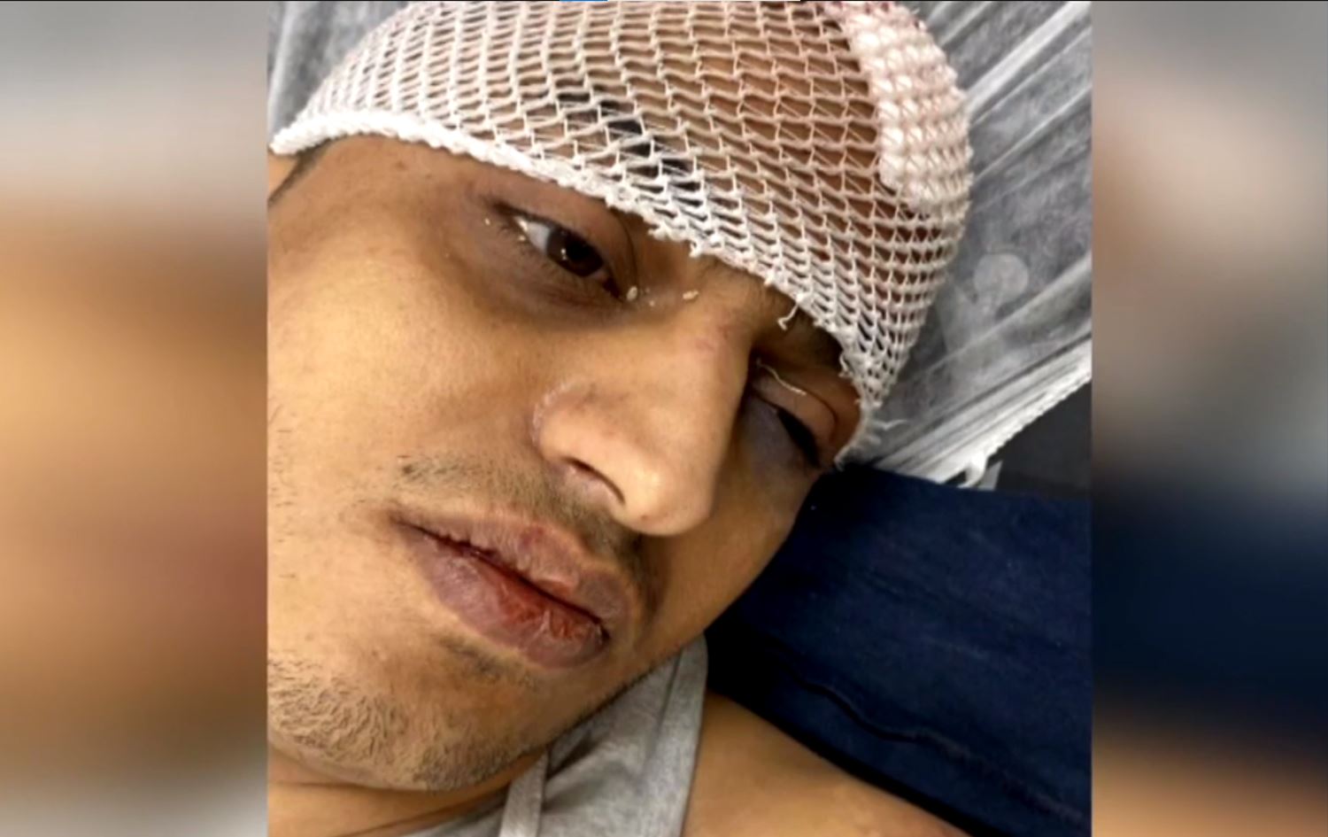 Di bombaraneke Babê de kesekî ku tê gotin serkirdeyê DAIŞê ye birîndar bû