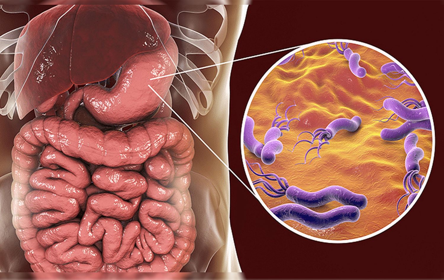 کۆنفرانسی کۆئەندامی هەرس لە میسر: بەکتریای گەدە بەبێ نیشانە مەترسیدار نییە