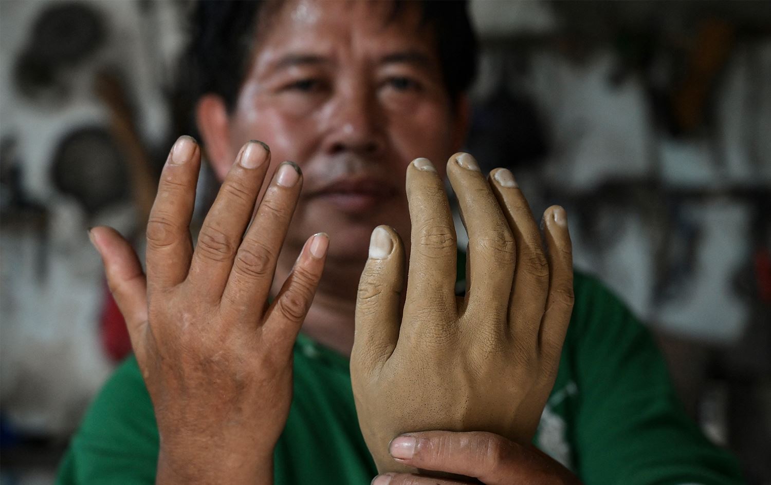 لە ئیندۆنیزیا چاکبوویێکی نەخۆشیی گەڕی پەلی دەستکرد بۆ تووشبووان دروستدەکات