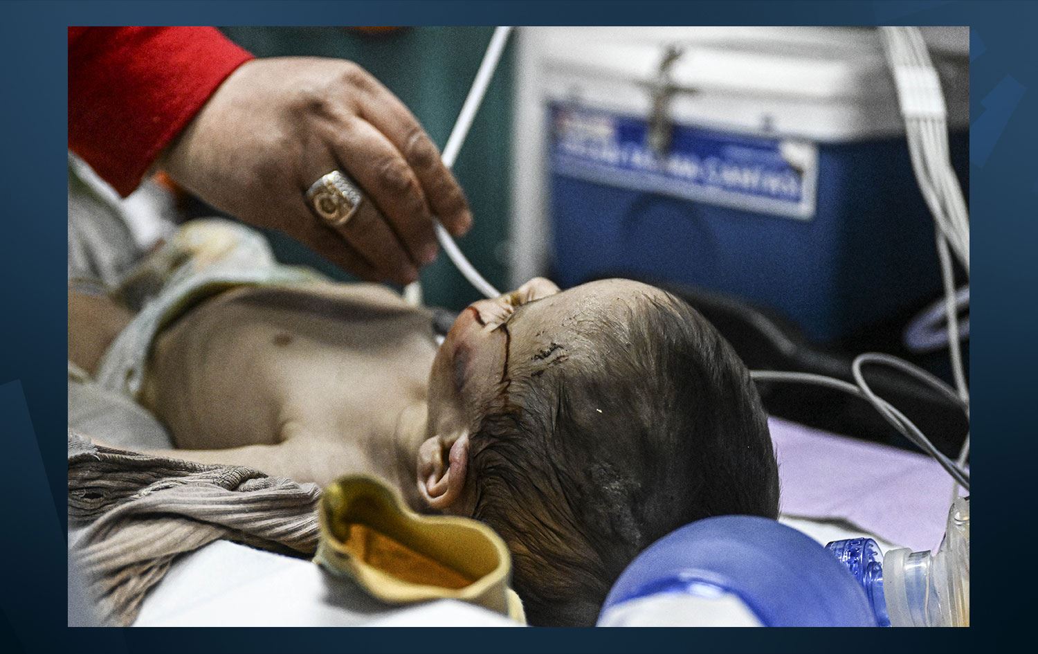 Enkaz altındaki 7 aylık bebek 140 saat sonra kurtarıldı