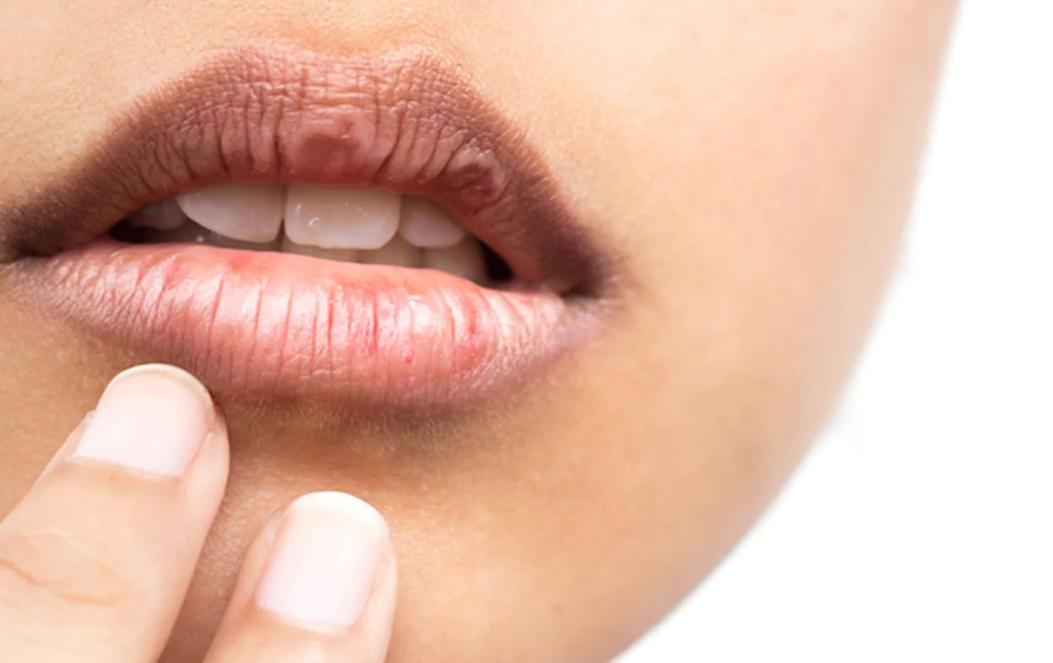 پسپۆڕێکی پێست هۆکار و رێگەکانی پێشگیریکردن لە وشکبوونی لێوەکان دەخاتەڕوو