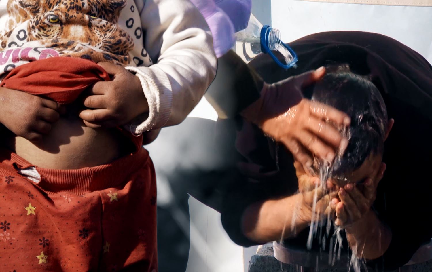 رووداو لە دیلۆکی باکووری کوردستان؛ نەخۆشیی پێست لەنێو قوربانییانی بوومەلەرزە بڵاوبووەتەوە