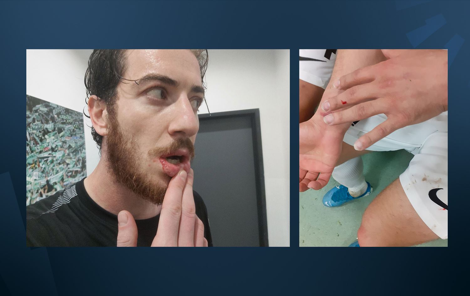 Lîstika Amedspor-Bursaspor: 4 yarîzan û 3 rêveberên Amedsporê rapora pizîşkî wergirtin