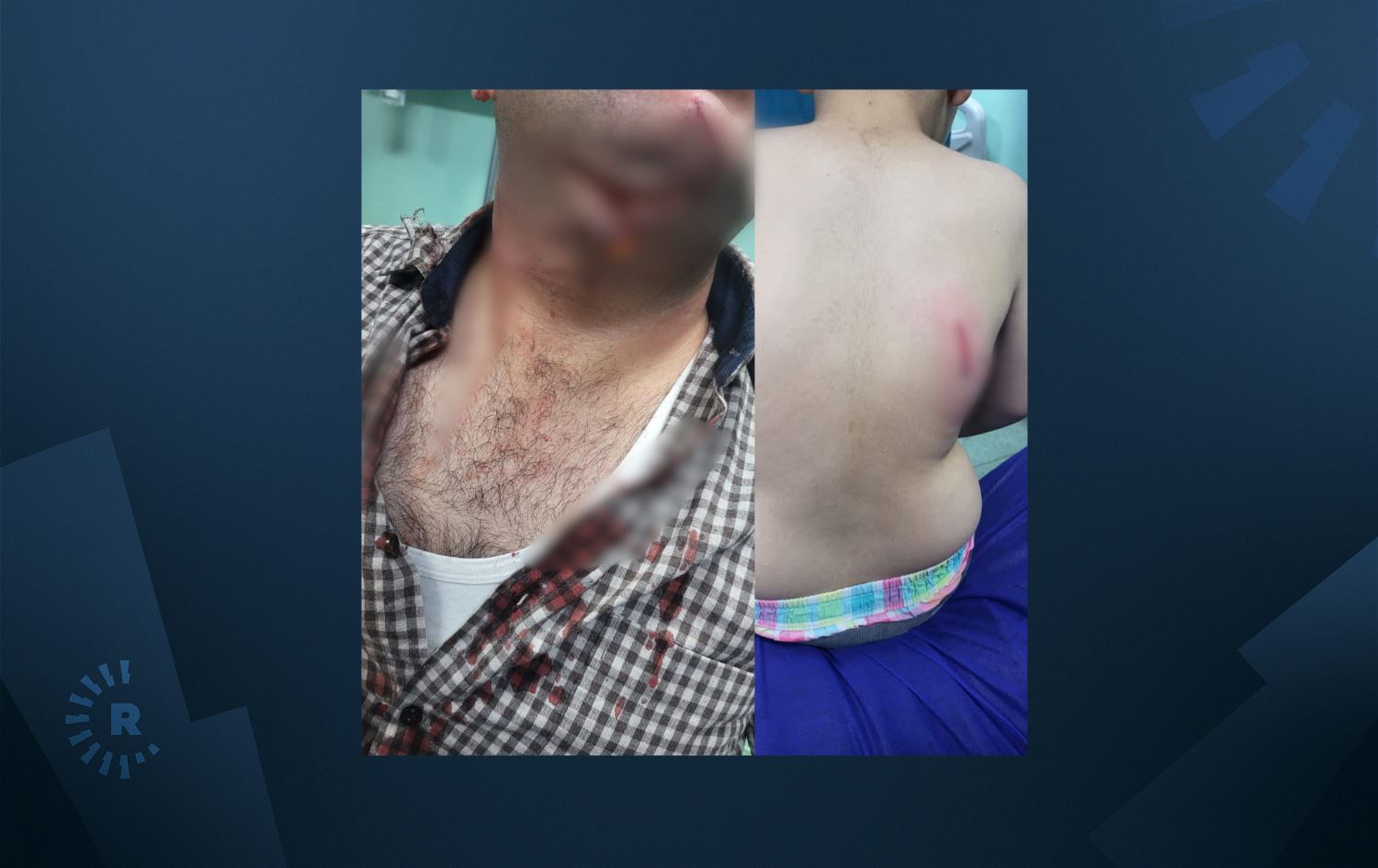 فریاکەوتنی رۆژئاوای هەولێر: ئەمڕۆ سەگی بێلانە هێرشیان کردووەتە سەر 9 کەس