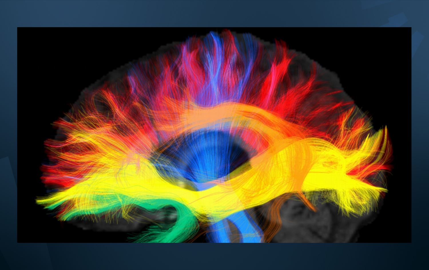 Zimanê zikmakî çawa şekil dide mêjiyê mirov?