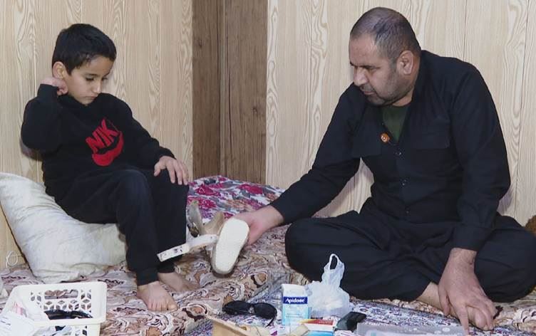 Qurbaniyekî çekên kîmyewî bi metirsiya jidestdana çavê xwe re rûbirû ye