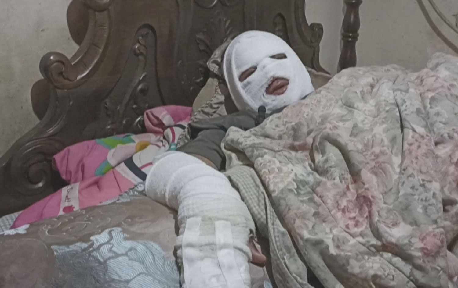 بەهۆی "خراپی کواڵێتیی بەنزین" سووتانی ئۆتۆمبێل لە ڤەنزوێلا بووەتە دیاردە