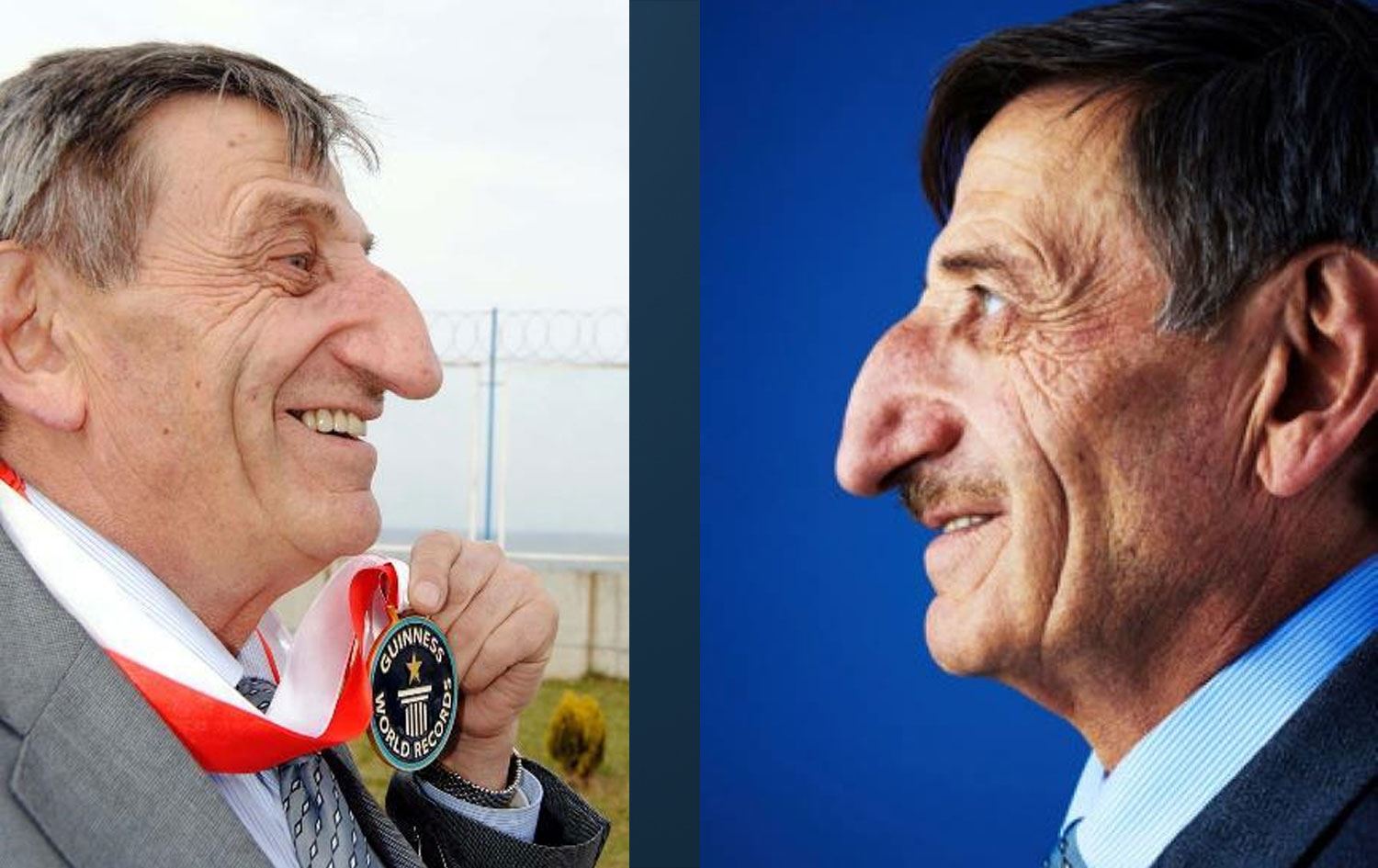 ‘Dünyanın en uzun burunlu insanı’ Özyürek hayatını kaybetti