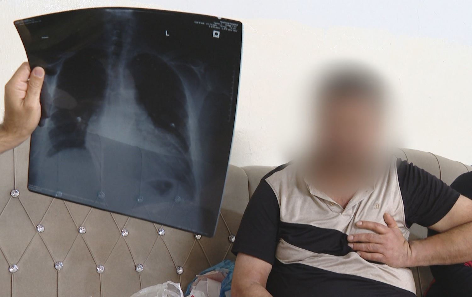 پیاوێک لە هەولێر پێویستی بە گۆڕینی دڵە؛ کرێچییە و 25%ی دڵی کار دەکات