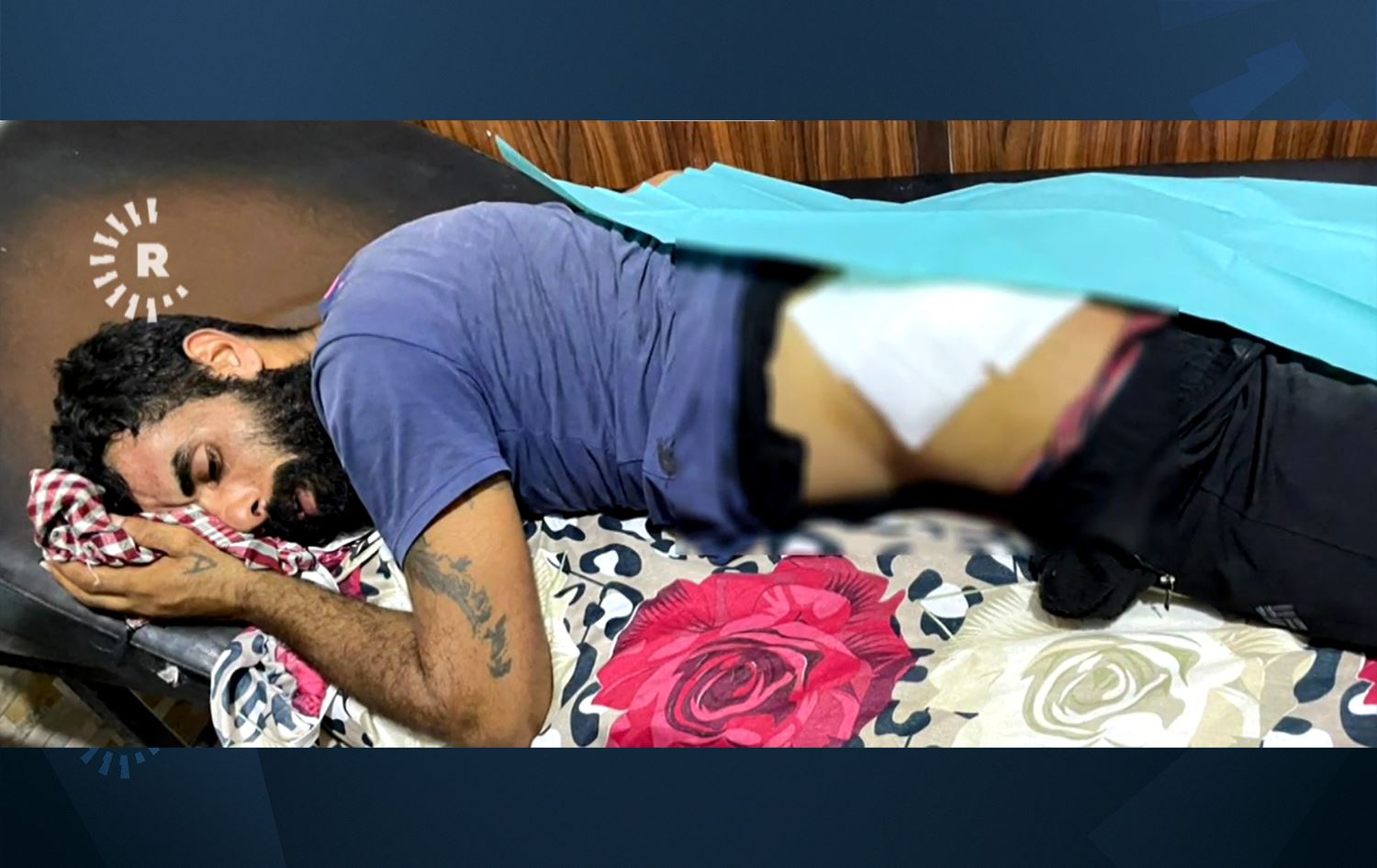 Birîndarekî topbaranê