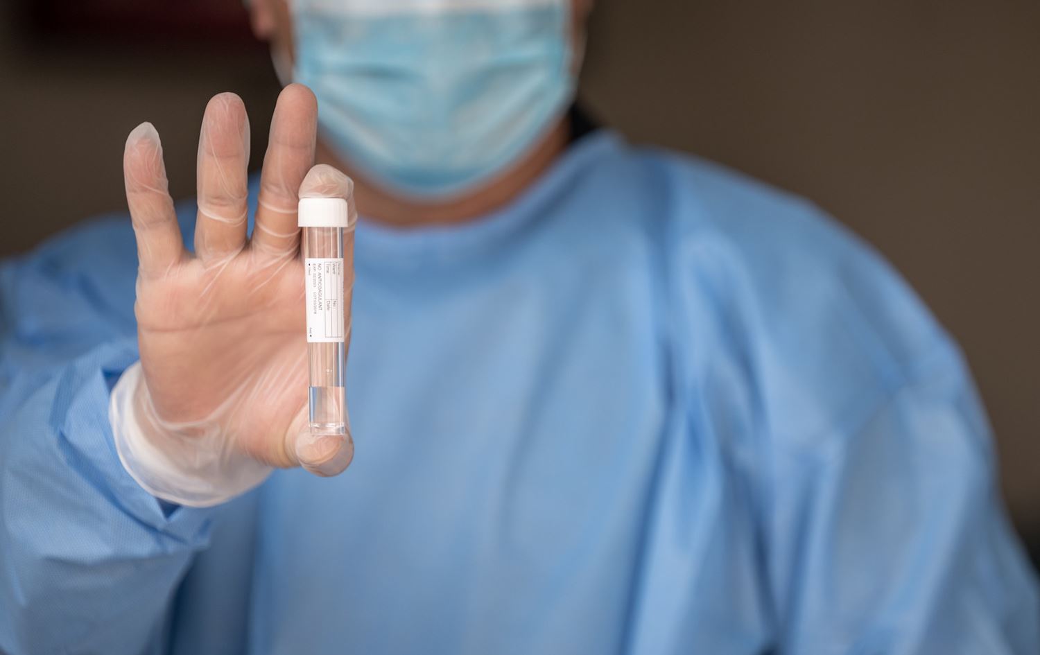 وزارة الصحة لرووداو: لا صحة لحدوث وفاة جراء المتحور الجديد لكورونا