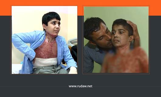 تداول صورة مصاب كوردي بالقصف التركي لرأس العين على أنها لطفل في غزة