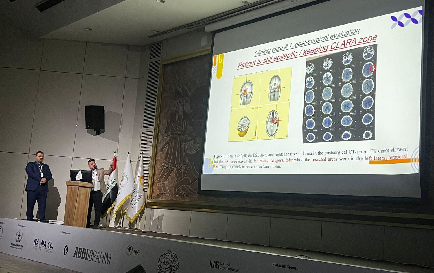 طبيب عراقي لرووداو: وجدت طريقة لعلاج الصرع بنسبة 95%