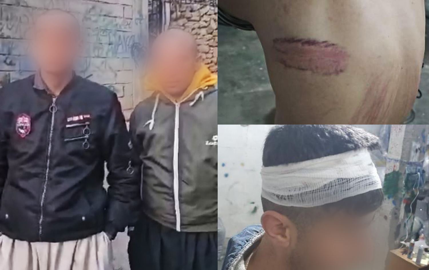 کۆڵبەرە "ئەشکەنجەدراوەکان"