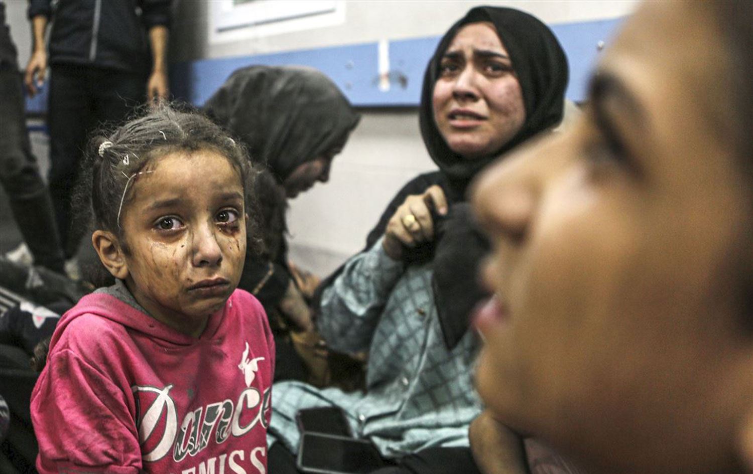 Gazze Şeridin'de yaralanan siviller Foto: Abed Khaled / AP