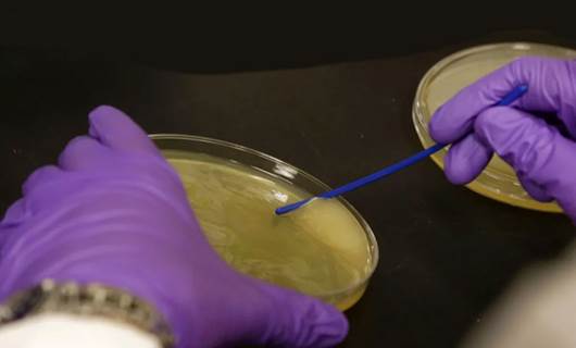 Japonya'da 'et yiyen' bakteri hızla yayılmaya başladı
