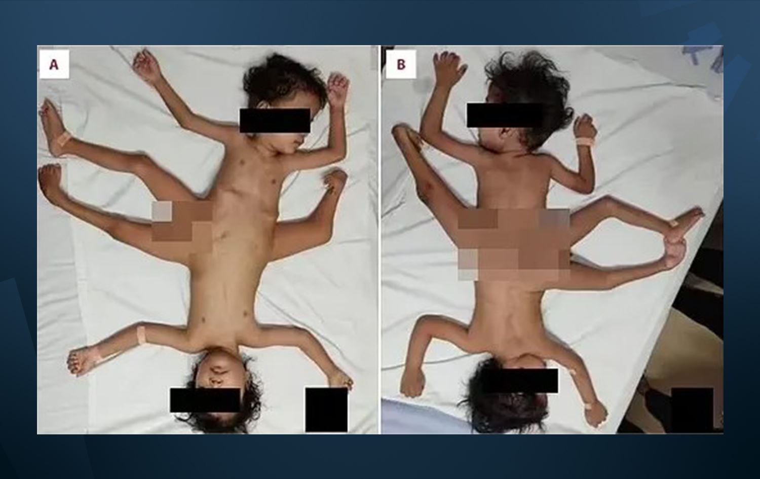 Wêne: American Journal of Case Reports