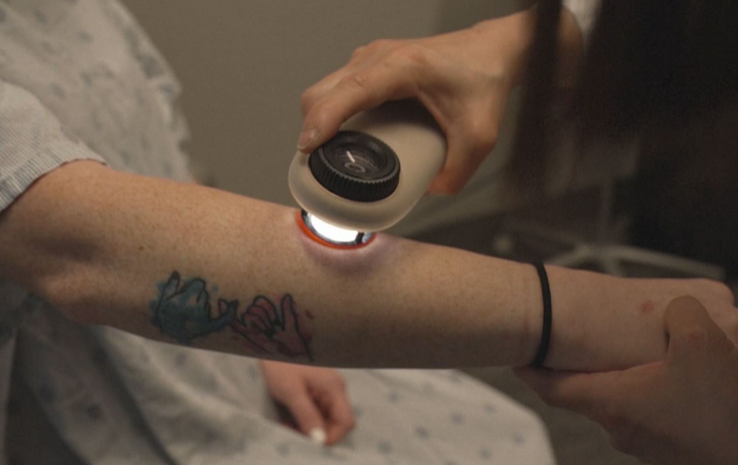 زانکۆی ئۆهایۆ لە ئەمریکا: پێستکاڵەکان ئەگەری تووشبوونیان بە شێرپەنجەی پێست زۆرە